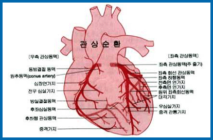 심혈관 촬영