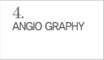 ANGIO GRAPHY