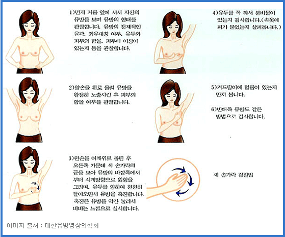 유방암 자가검진 관련 이미지