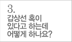 갑상선 혹이 있다고 하는데 어떻게하나요?