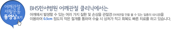 어깨관절 재활운동 동영상보기- BHS한서병원 어깨관절 클리닉에서는 어깨에서 발생할 수 있는 여러 가지 질환 및 손상을 관절경 (어깨관절 안을 볼 수 있는 일종의 내시경)을 이용하여 0.5cm 정도의 작은 절개를 통하여 수술 시 상처가 적고 회복도 빠른 치료를 하고 있습니다.