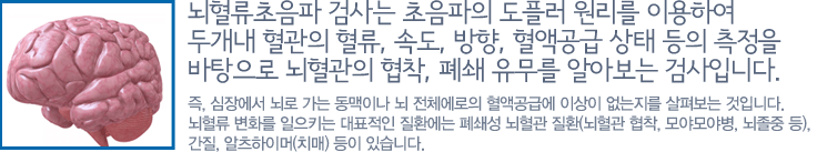 뇌혈류초음파 검사는 초음파의 도플러 원리를 이용하여 두개내 혈관의 혈류, 속도, 방향, 혈액공급 상태 등의 측정을 바탕으로 뇌혈관의 협착, 폐쇄 유무를 알아보는 검사입니다. 즉, 심장에서 뇌로 가는 동맥이나 뇌 전체에로의 혈액공급에 이상이 없는지를 살펴보는 것입니다. 뇌혈류 변화를 일으키는 대표적인 질환에는 폐쇄성 뇌혈관 질환(뇌혈관 협착, 모야모야병, 뇌졸중 등), 간질, 알츠하이머(치매) 등이 있습니다.