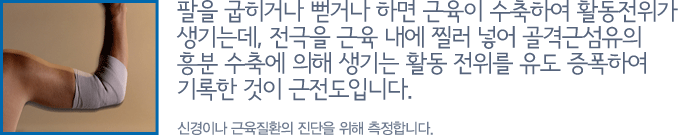 뇌혈류초음파 검사는 초음파의 도플러 원리를 이용하여 두개내 혈관의 혈류, 속도, 방향, 혈액공급 상태 등의 측정을 바탕으로 뇌혈관의 협착, 폐쇄 유무를 알아보는 검사입니다. 즉, 심장에서 뇌로 가는 동맥이나 뇌 전체에로의 혈액공급에 이상이 없는지를 살펴보는 것입니다. 뇌혈류 변화를 일으키는 대표적인 질환에는 폐쇄성 뇌혈관 질환(뇌혈관 협착, 모야모야병, 뇌졸중 등), 간질, 알츠하이머(치매) 등이 있습니다.